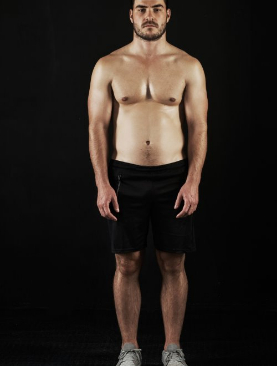 Metamorfoza – 3 - przed